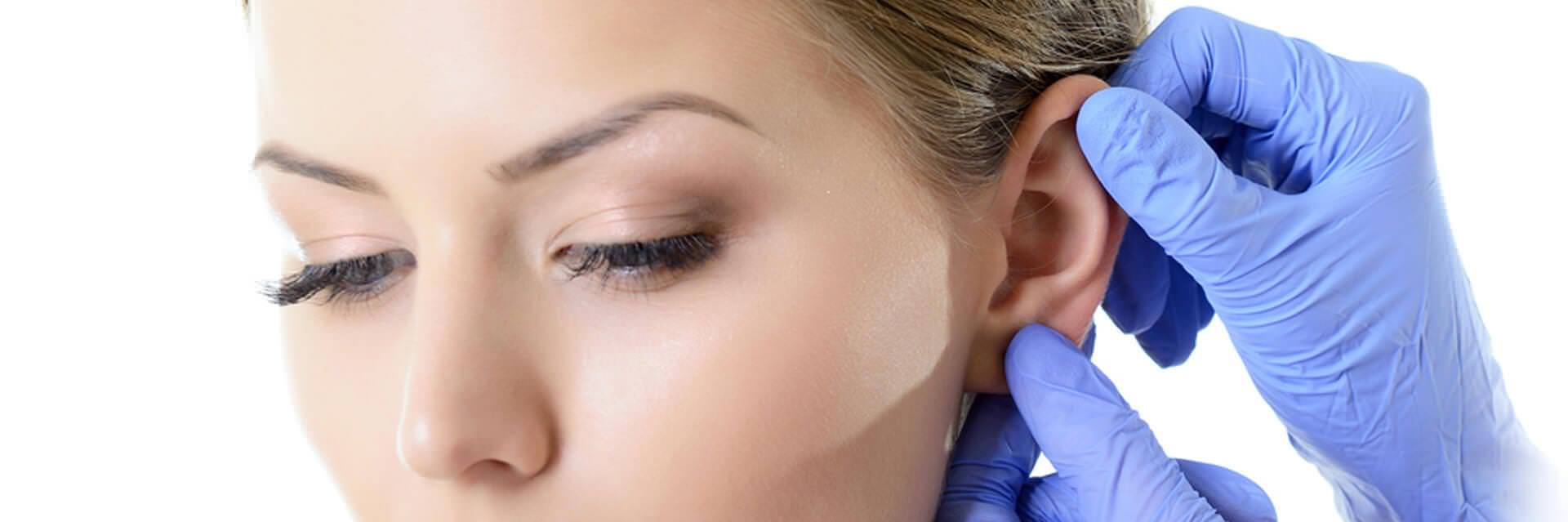 OTOPLASTIE – CHIRURGIE DES OREILLES